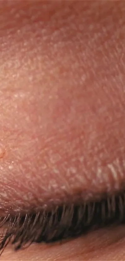 Close-up of skin texture with visible lines.