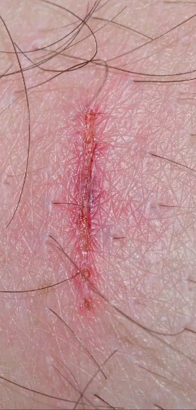 Close-up of skin texture with visible hair and natural pink tones.