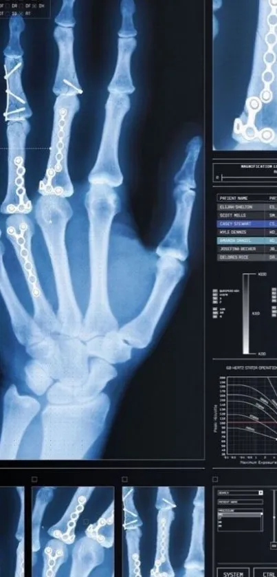 Futuristic X-ray of a hand with digital overlays and data readouts.