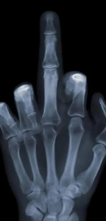 X-ray of a skeleton hand on black background.