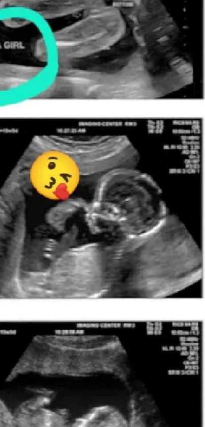 Ultrasound wallpaper showcasing a baby girl surprise.