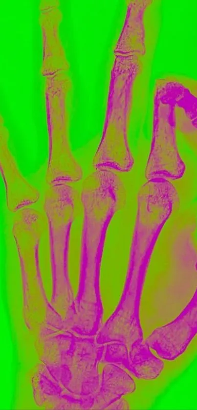 Colorful skeleton hand on green background.