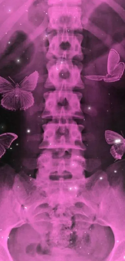 Pink X-ray spine with butterflies on wallpaper.