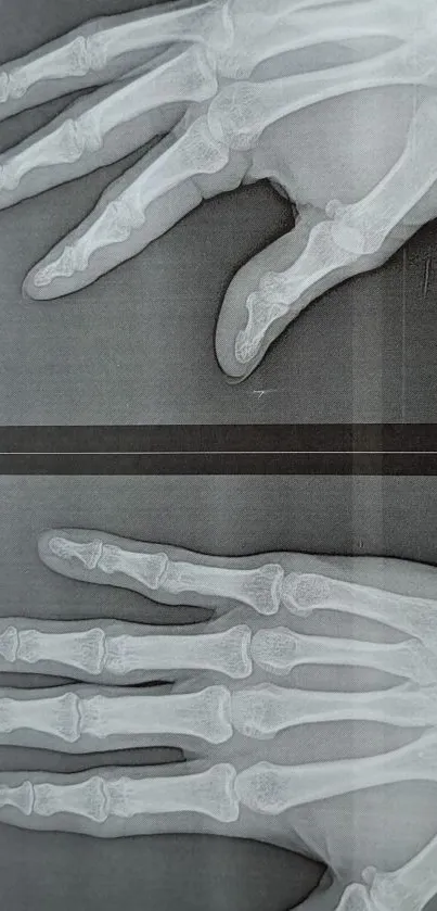 X-ray image of hands showcasing bone structure.