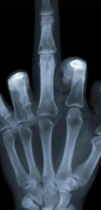 X-ray image of a skeleton hand on a black background.