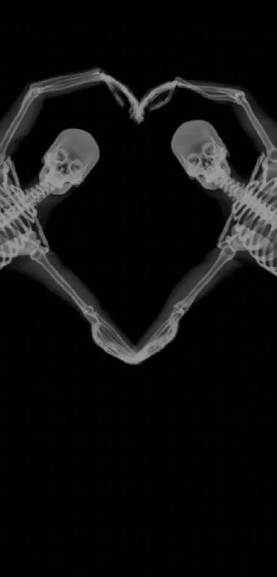 X-ray of two skeletons forming a heart on black background.