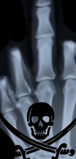 X-ray of a hand with skull and swords design