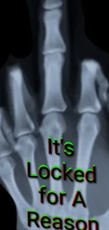 X-ray of a hand with middle finger up.