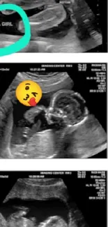 Ultrasound wallpaper showcasing a baby girl surprise.