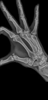 X-ray image of a hand skeleton on a black background.