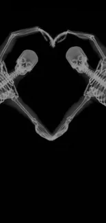 X-ray of two skeletons forming a heart on black background.