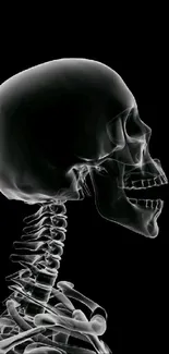 X-ray image of human skull on a black background.